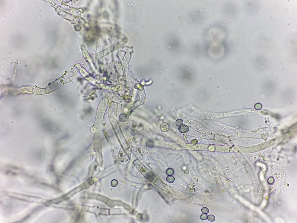 Image of white mold under microscope